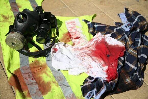 Yasin's clothes after he was shot, covered in blood from his wounds. (Photo: Hamde Abu Rahma)