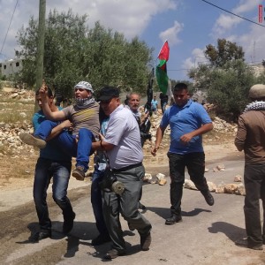 Protestor shot in his leg with live ammunition during protest in West Bank village of Kafr Qaddum. (Photo: International Solidarity Movement)