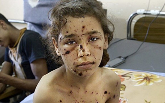 Nine-year-old girl injured by shrapnel, in Gaza. Photo from Telegraph/Rex