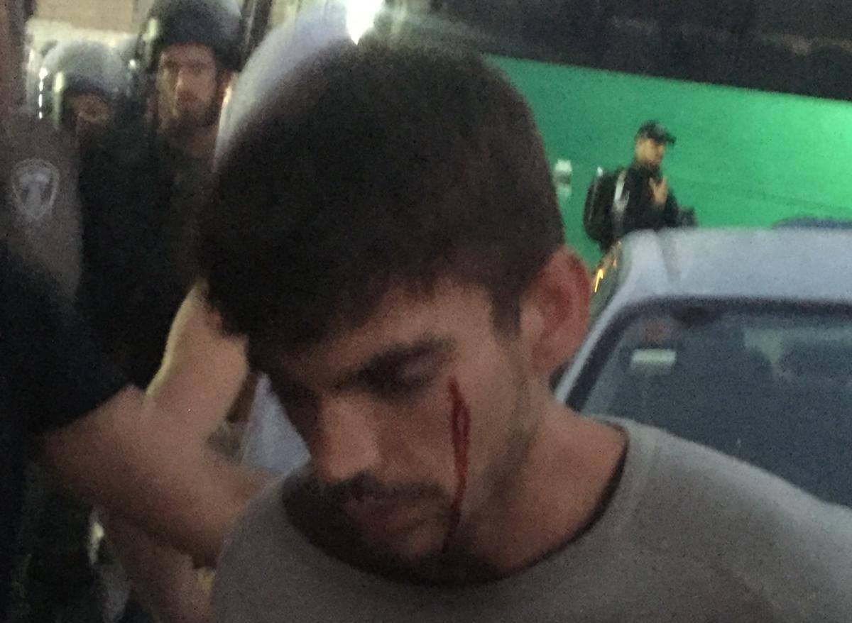 Open wound of Ivan Rivera, a Spanish activist (Photo: ISM)