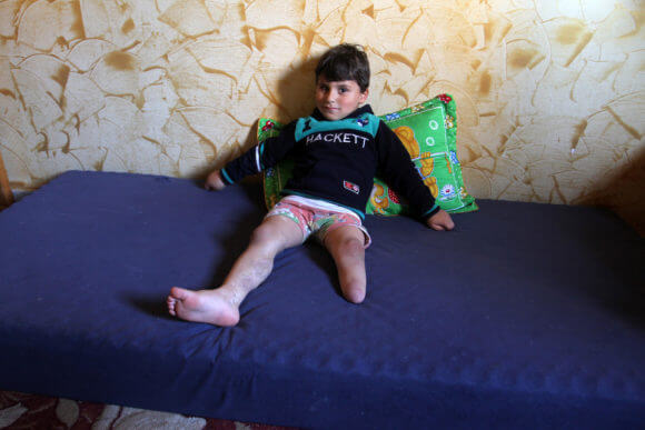 Sharif al-Namla who was injured during the 50-day war between Israel and Hamas in the summer of 2014, sits at his house on Feb. 28, 2016 in Rafah in the southern Gaza Strip. (Photo: Abed Rahim Khatib/APA Images)