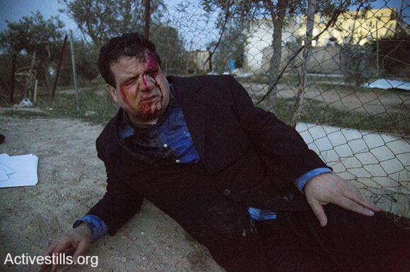 Head of the Joint List Ayman Odeh, injured by Israeli border police during a demonstration against the demolition of the Bedouin village of Umm al-Hiran, outside of Beersheva, Israel, January 18, 2017. Odeh tweeted the foto, shot by Activestills.