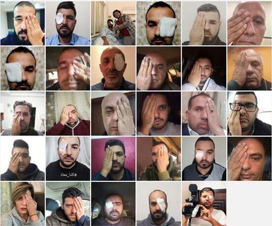 A photo of people covering their eye in solidarity with Muath Amarneh, a Palestinian photojournalist shot in the face by Israeli forces while covering a protest in the West Bank.
