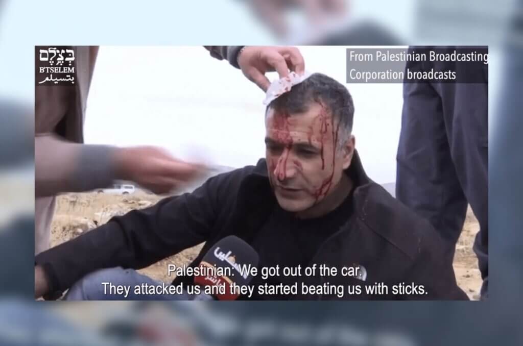 On January 13, ‘Iz a-Din Zein a-Din, a resident of a village near Nablus, was beaten severely by Israeli settlers as he protested their seizure of his land. Screenshot from B'Tselem video.