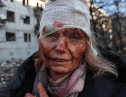 A woman wounded from a Russian airstrike on an apartment complex outside of Kharkiv, Ukraine. (Photo: Anadolu Agency)