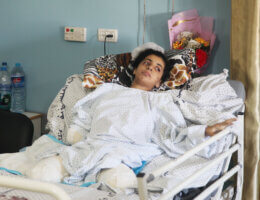Rahaf Salman, 11, receives treatment at a hospital in the northern Gaza Strip on August 9, 2022. Salman lost both her feet and her right hand during the latest Israeli aggression on the Gaza Strip. (Photo: Omar Ashtawy/ APA Images)