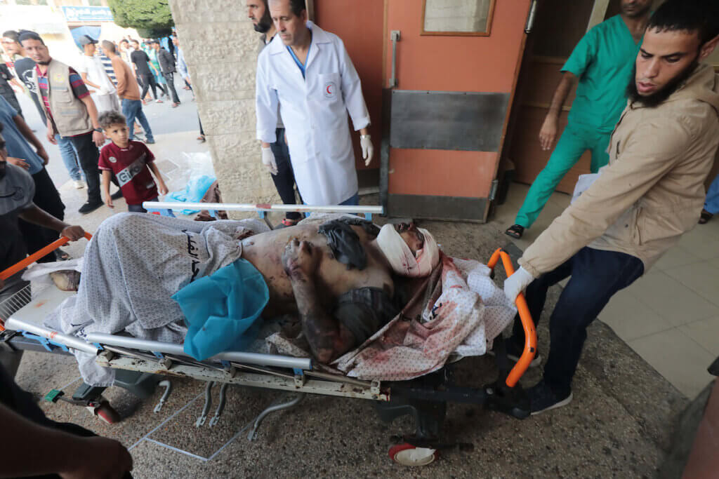 Palestinians wounded in Israeli airstrikes at a hospital in Deir al-Balah, south of the Gaza Strip, October 17, 2023. A man with a blackened half-burnt body is brought in on a stretcher.