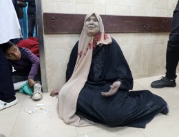 An injured Palestinian woman sits on the floor of a hospital in Gaza covered in blood and dust