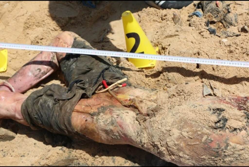 The Euro-Med Human Rights Monitor said the exhumation revealed "the presence of urinary catheters or splints that were still attached to some patients' bodies." (Photo: Social Media)