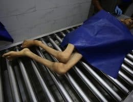 The body of 28-year-old Palestinian Hamada Nael Warsh Agha is brought to Al-Shifa Hospital in Gaza City for funeral procedures, after he died from malnutrition caused by Israel's blockade and restrictions that have severely limited access to basic food supplies in Gaza, on August 26, 2025. (Photo: Omar Ashtawy/APA Images)