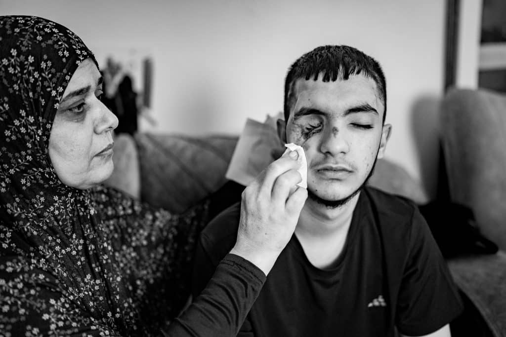 Amira Ararawi cleans the wound of her nephew, Kemal, in Jenin refugee camp. In the summer of 2023, Kemal went to help his cousin, Amira’s son, Majdy Ararawi, who was shot outside their home in the camp during a raid by the Israeli army. As Kemal approached Majdy, attempting to attend to his cousin’s wounds, an Israeli sniper shot Kemal through the side of his head, and the bullet entered his cousin’s neck, killing Madjy and blinding Kemal for life. Kemal survived the gunshot but is now blind in both eyes, and currently studying to be an Imam (Photo: David Lombeida)