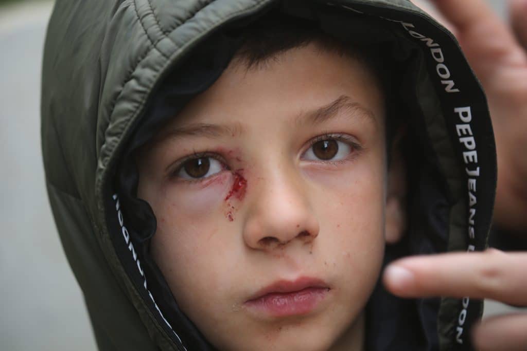 Mustafa Bani Odeh, 8, is one of two surviving children from the Bani Odeh family, who was shot at by Israeli forces in Tammoun, killing four members of the family, March 15, 2026. (Photo: Mohammed Nasser/APA Images)