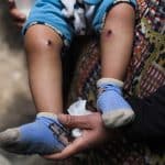 18-month-old Jawad Abu Nassar was returned by the Israeli army top his family with burn marks and puncture wounds, in what the family says was the result of torture, according to doctors, March 24, 2026. (Photo: Ramzi Abu Amer/APA Images)