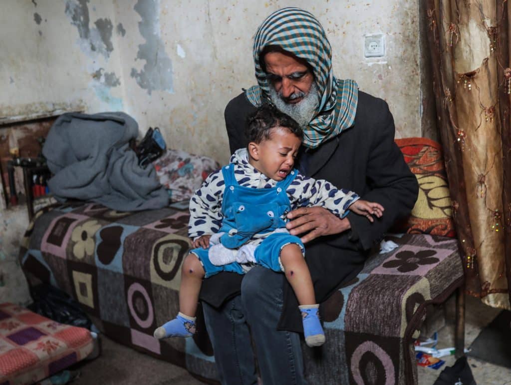18-month-old Jawad Abu Nassar was returned by the Israeli army top his family with burn marks and puncture wounds, in what the family says was the result of torture, according to doctors, March 24, 2026. (Photo: Ramzi Abu Amer/APA Images)