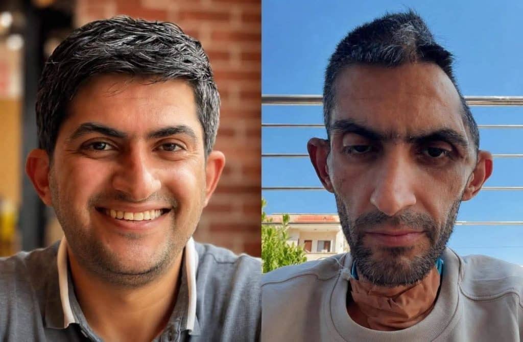 Mujahed Mofleh was released from Israeli detention in January 2026 after six months of imprisonment and went into a coma two days later. Seven months after being released, he will never be the same. (Photo: Social Media)