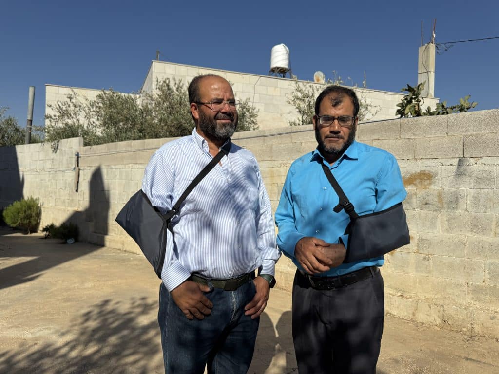 Members of the Abu Alia family in the West Bank village of al-Mughayyir have had their arms broken by Israeli settlers and the army. (Photo: Shatha Hammad)